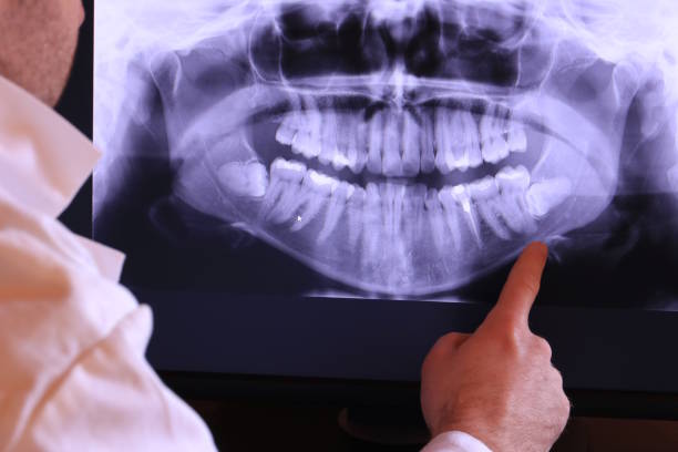 Best Weekend Emergency Dentist in New Lno, LA